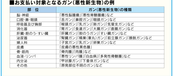 ■お支払い対象となるガン(悪性新生物)の例